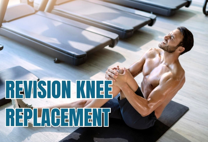 Revision Knee Replacement Surgery by Dr Karthik Gudaru